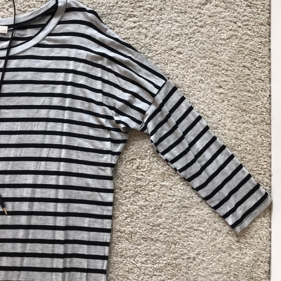 Striped Tunic/Dress - Picture 3 of 5